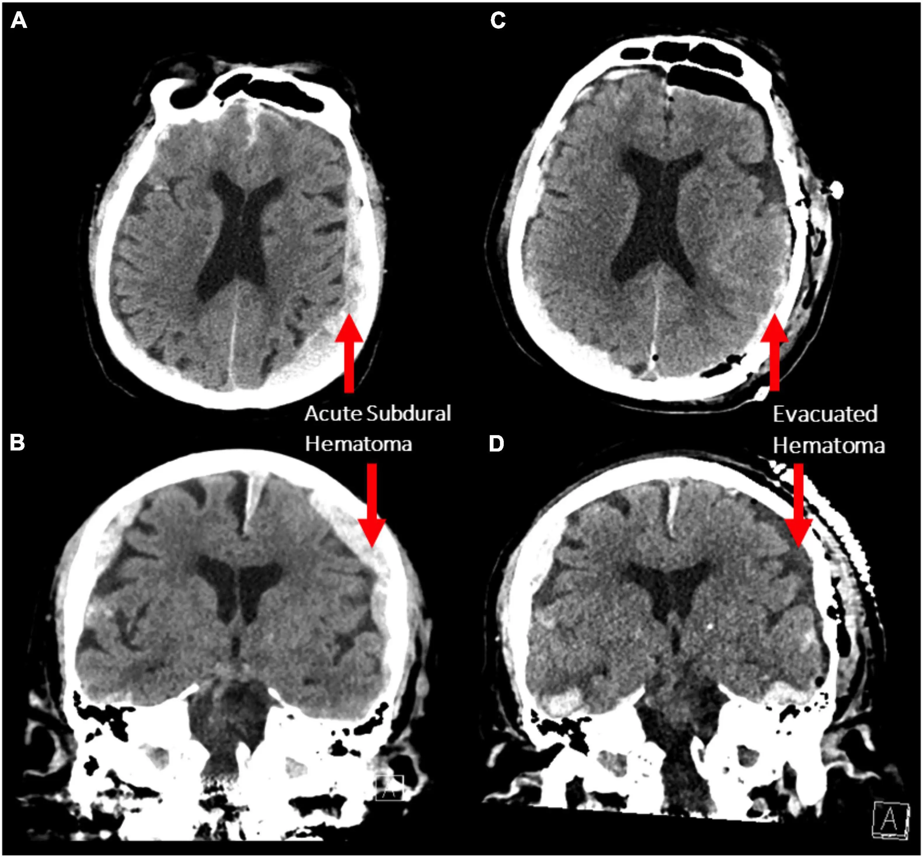 Brain scans of the dying patient (Frontiers of Ageing in Neuroscience/CC BY 4.0)