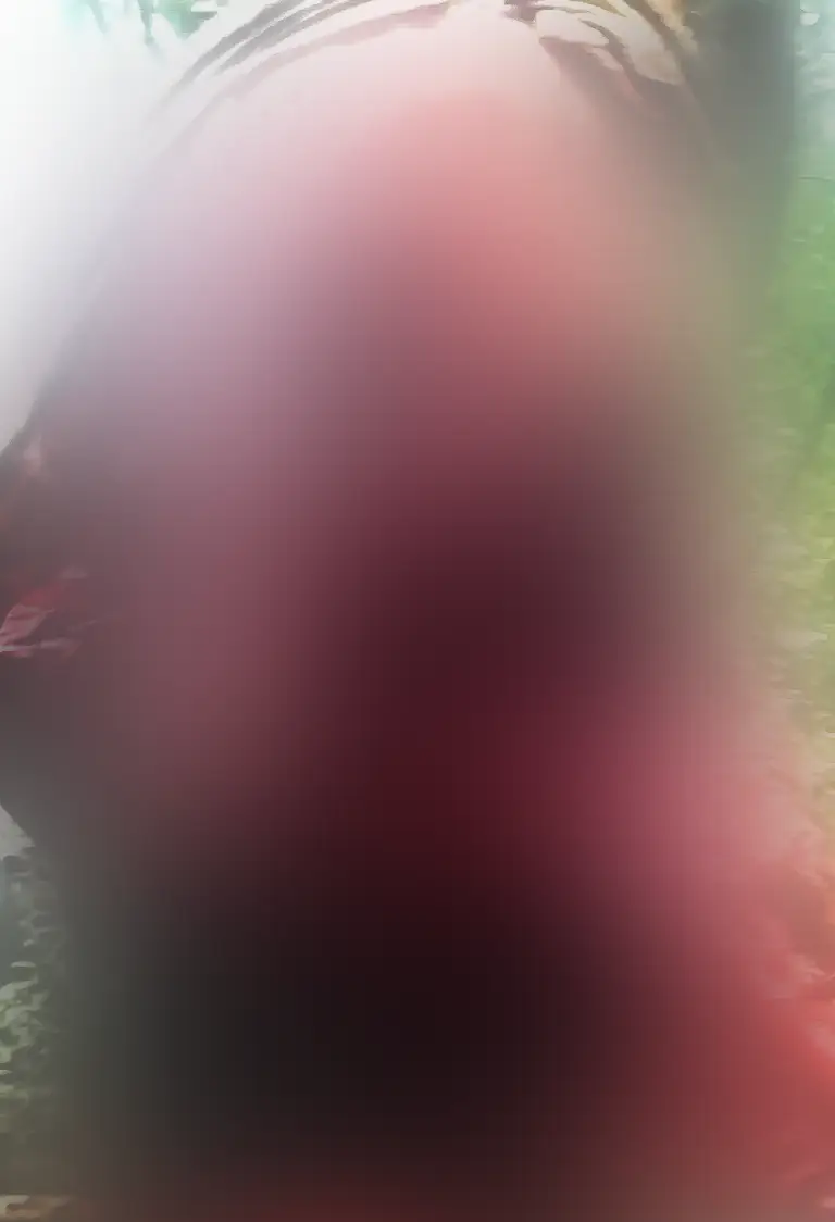 Jeremy's face was entirely ripped away by the bear.