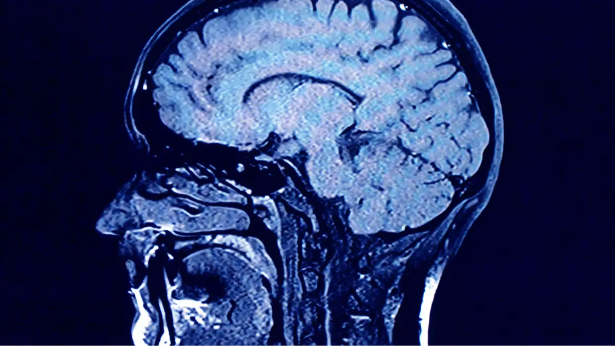 Getty Images/Roxana Wegner