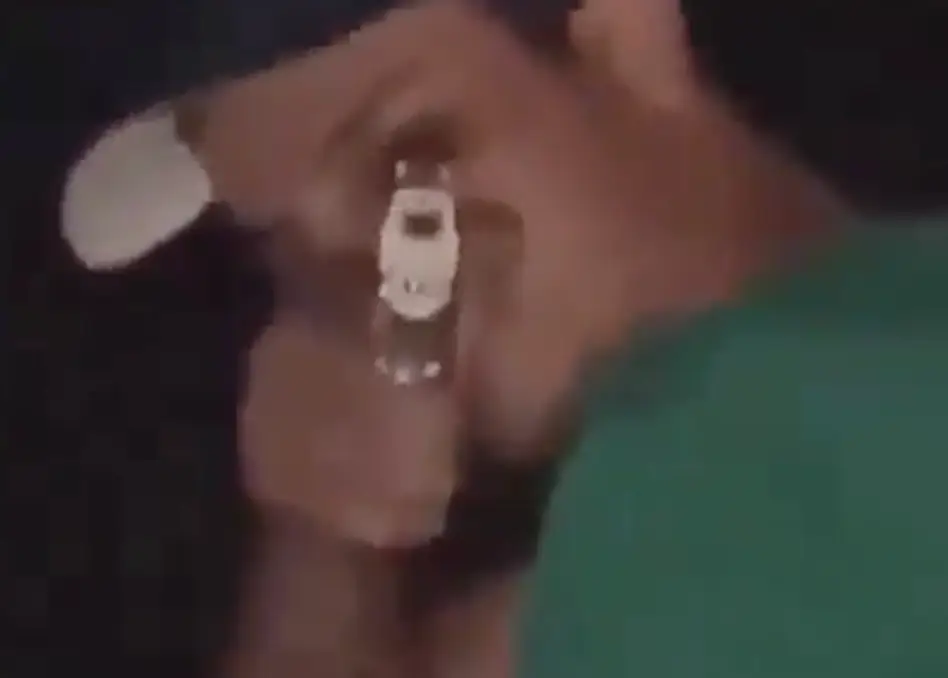 Alves died from the gunshot wound. (X)