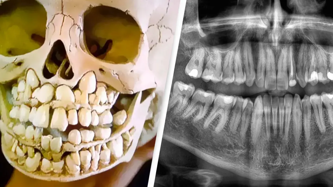 People terrified after seeing what a child's skull looks like