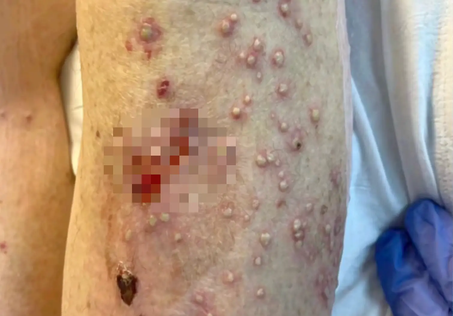 The care home eventually called emergency services after recognizing the severity of the injuries (WCBD NEWS 2)