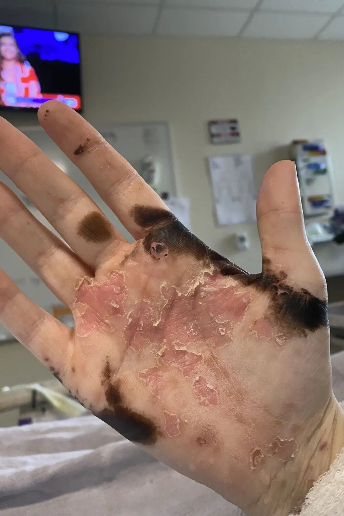 The mom was given a five-ten percent survival rate (Kennedy News)