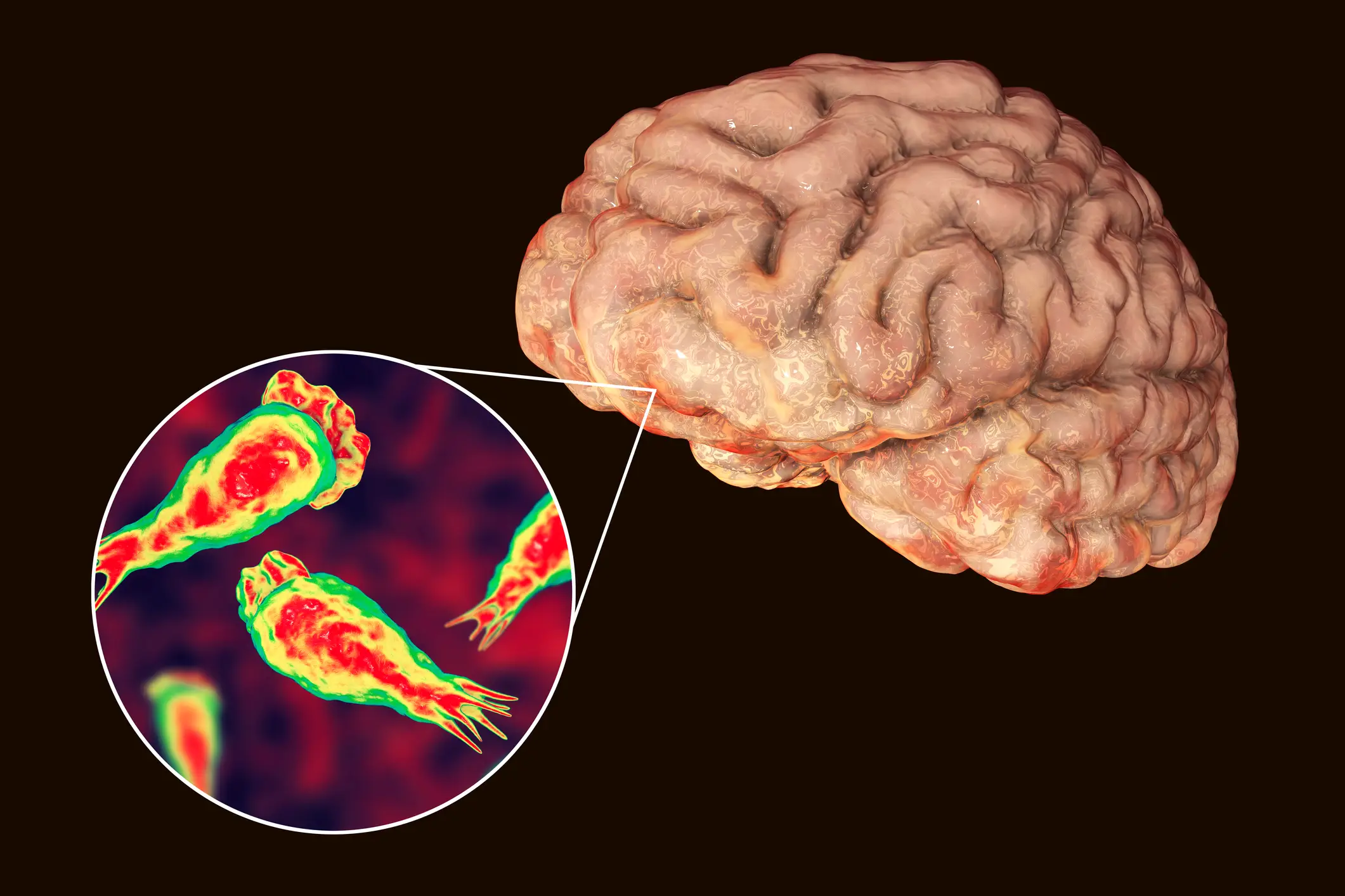 The brain eating amoeba can be fatal if not treated promptly. (Getty Stock Images)