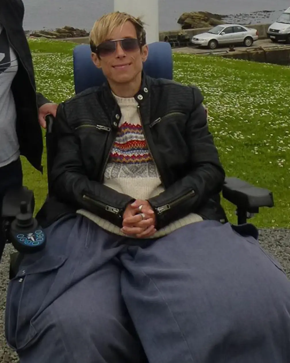 Mandy Sellars was born with a rare genetic condition.