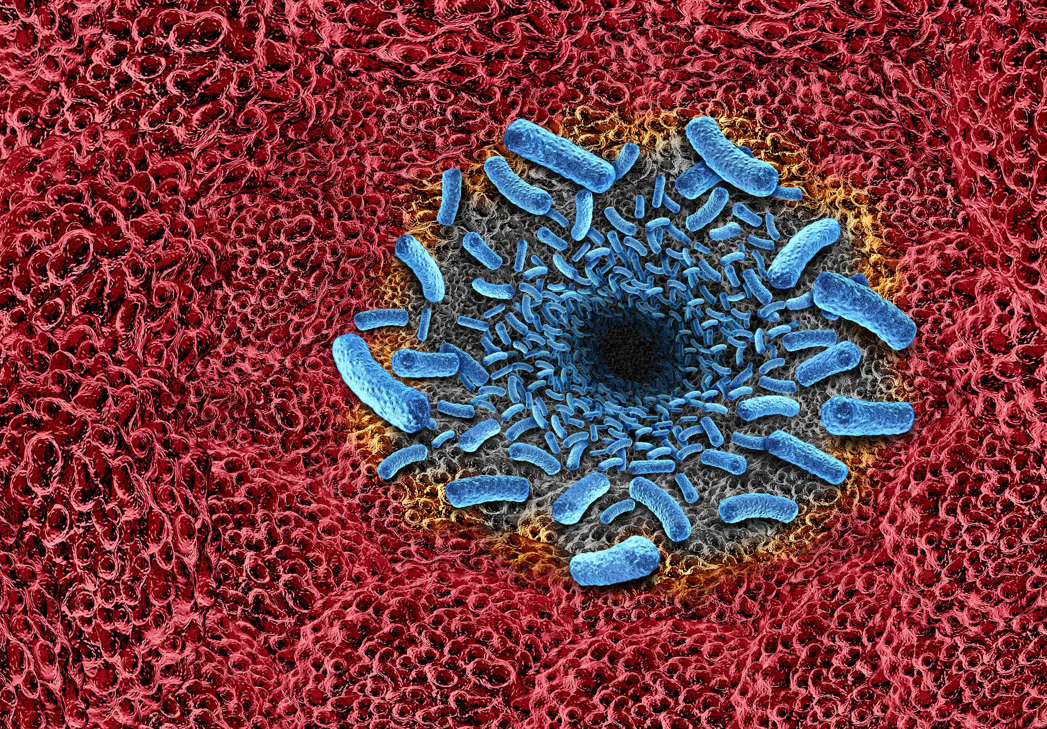 Necrotizing fasciitis is a rare condition (Getty Stock Images)