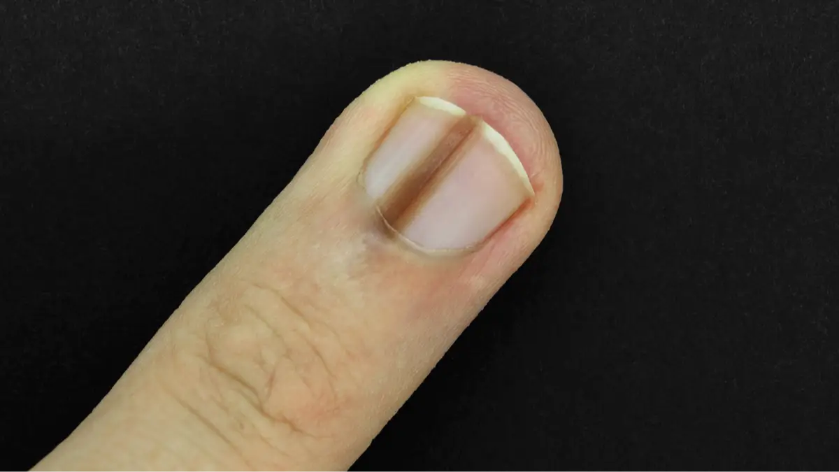 Getty Images/Rytis Bernotas