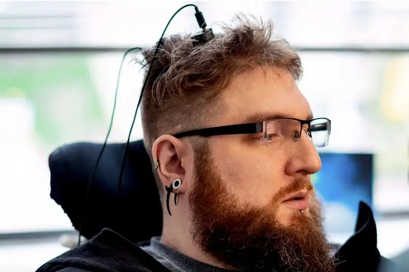 Here's Nathan Copeland, one of the people that have already had a chip implanted.