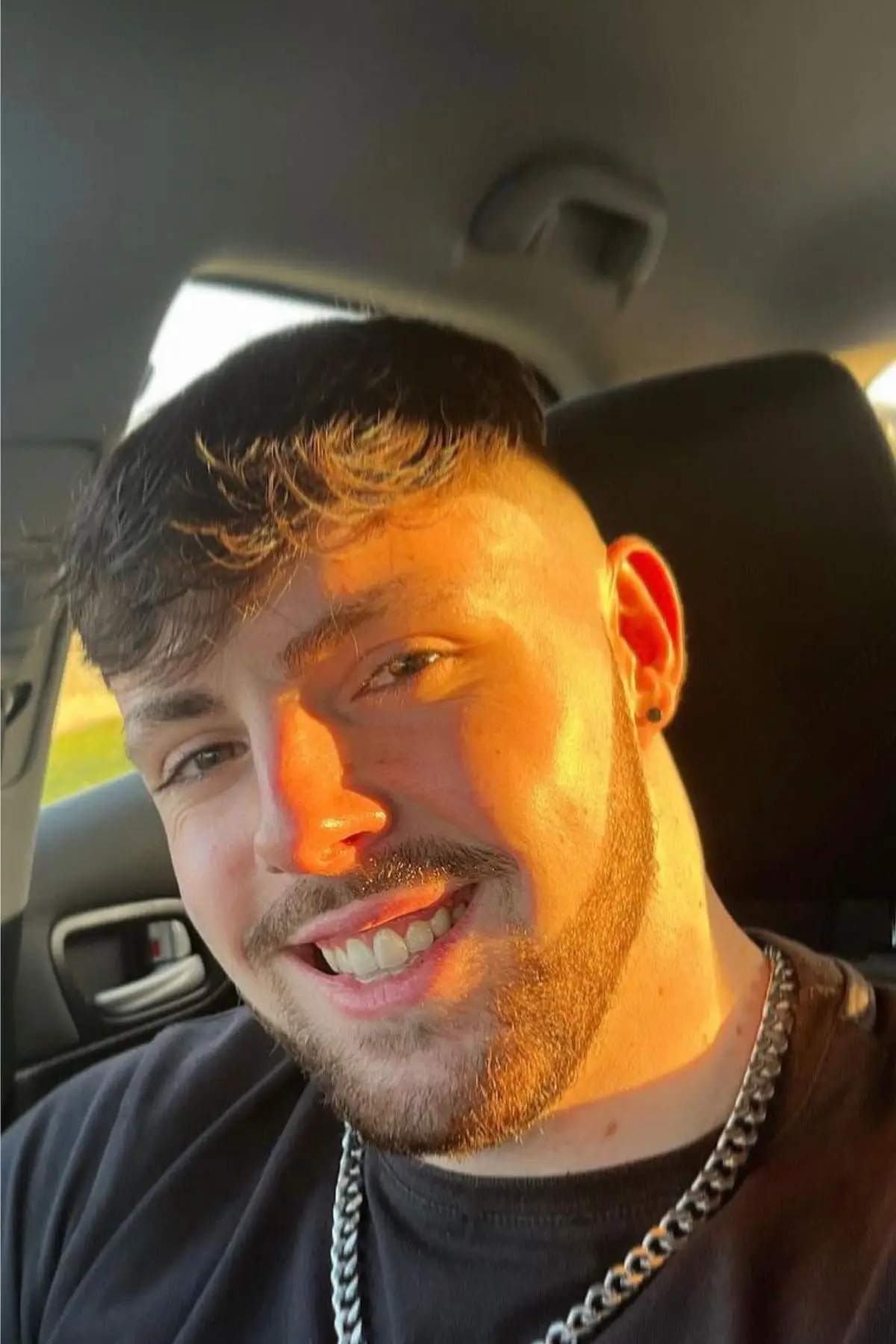 A Welsh influencer has issued a warning after he 'ignored' expert advice about his hair transplant (SWNS)