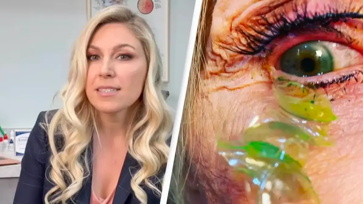 @california_eye_associates/Instagram