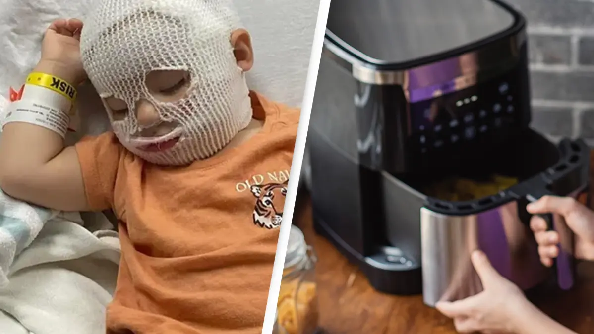 Mom issues urgent warning after 1-year-old son suffers extreme burns from air fryer