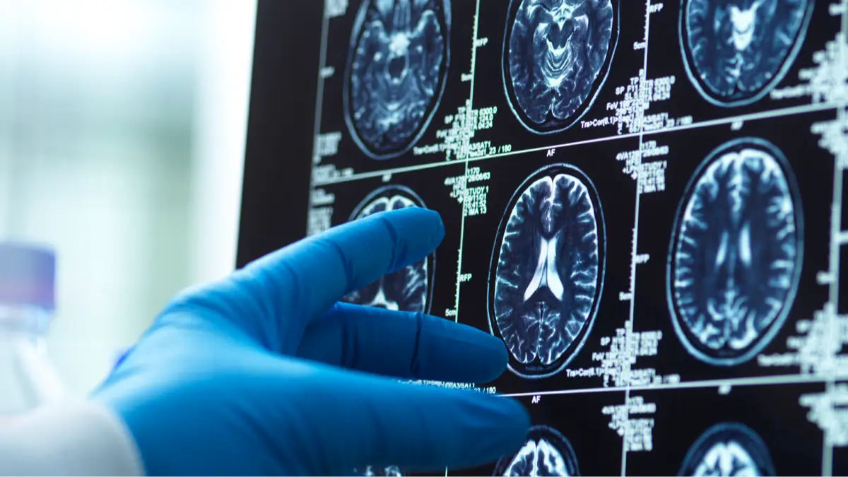 Getty Images/Andrew Brookes