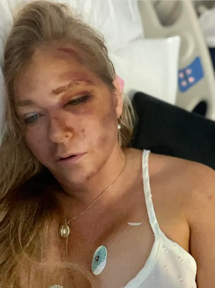 Virginia Giuffre took to Instagram to share that she was involved in a car accident (Instagram/@virginiarobertsrising11)