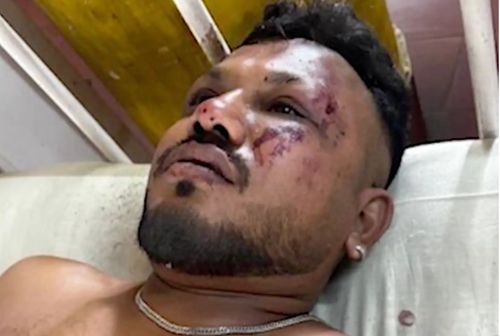 Lone survivor Vishwash Kumar Ramesh spent time in hospital (CNN)