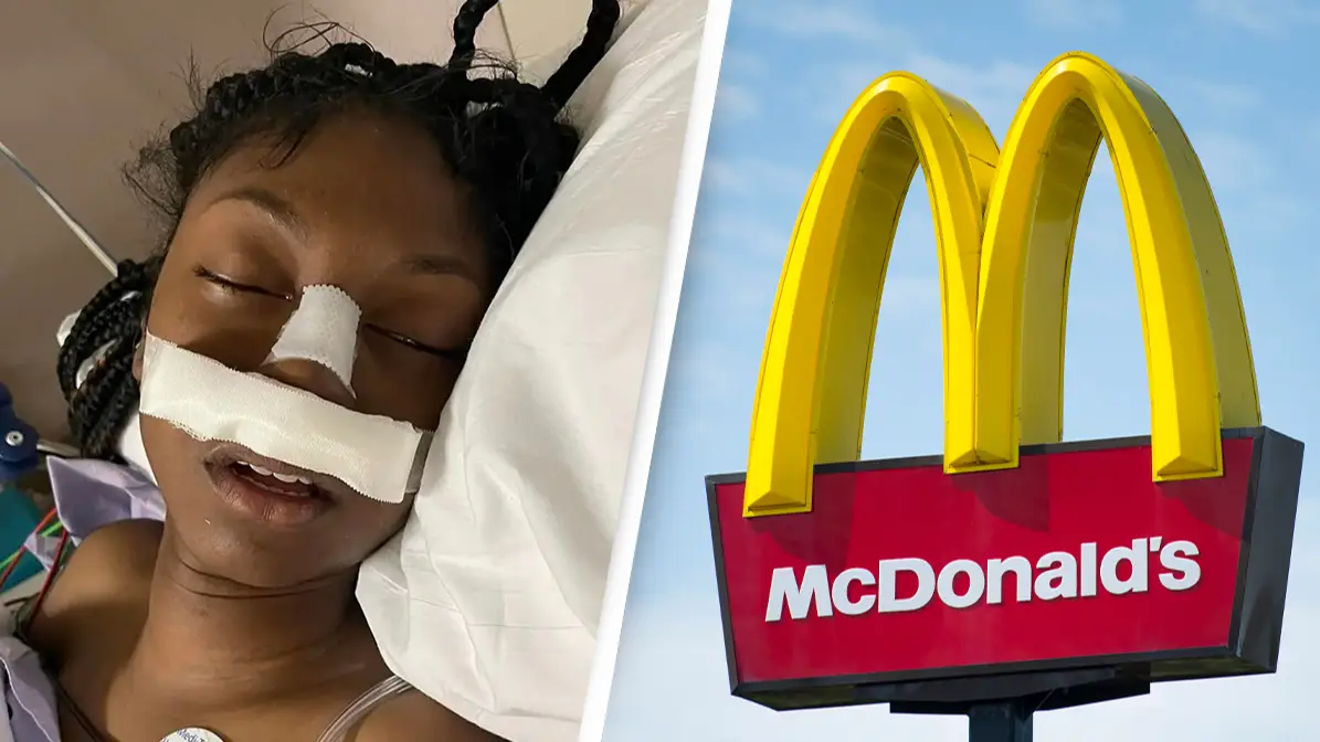 McDonald’s worker, 15, left with fractured skull after customer 'stomped on her head during brawl'