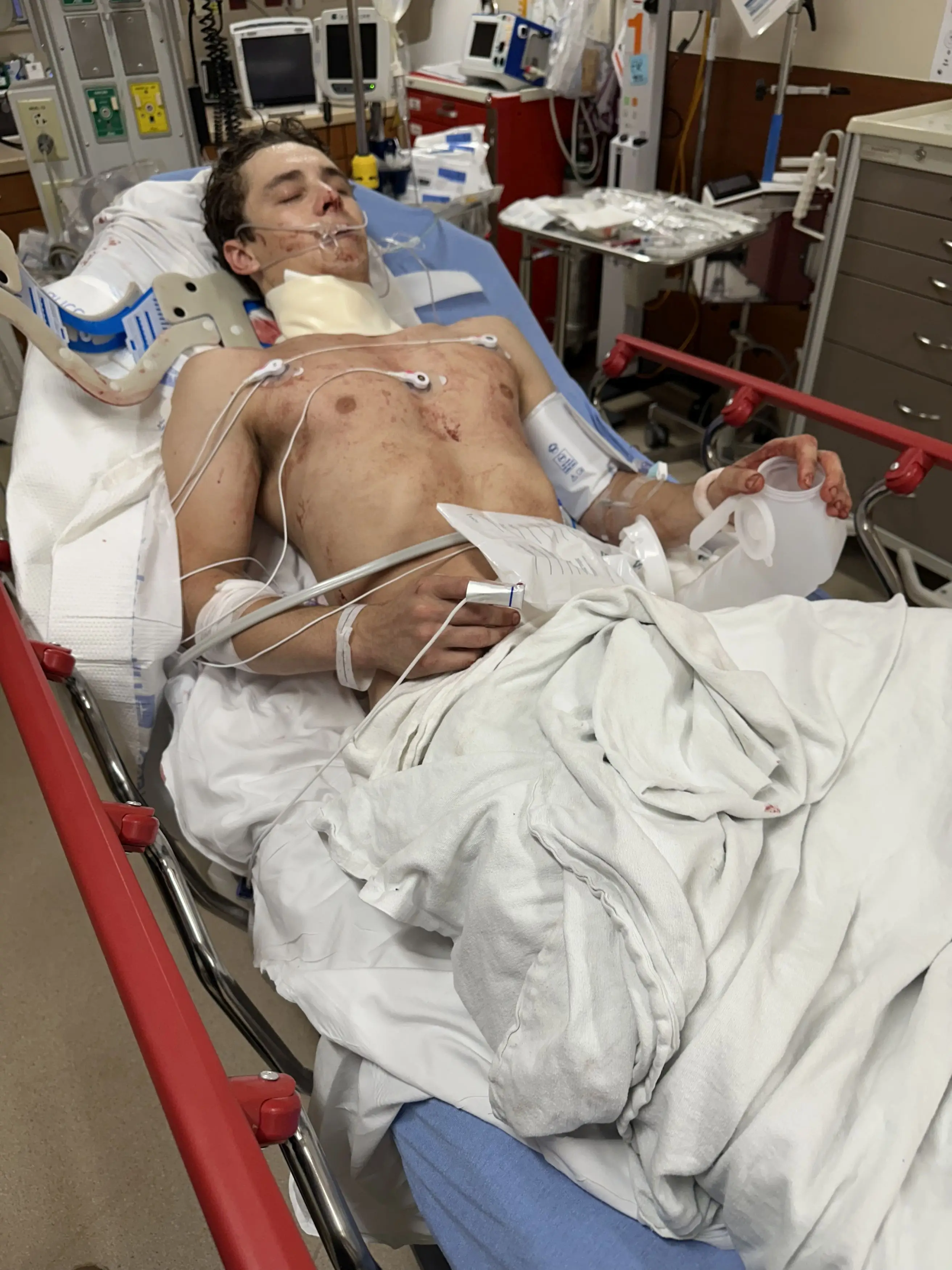 The bull rider nearly died (Kennedy News and Media)