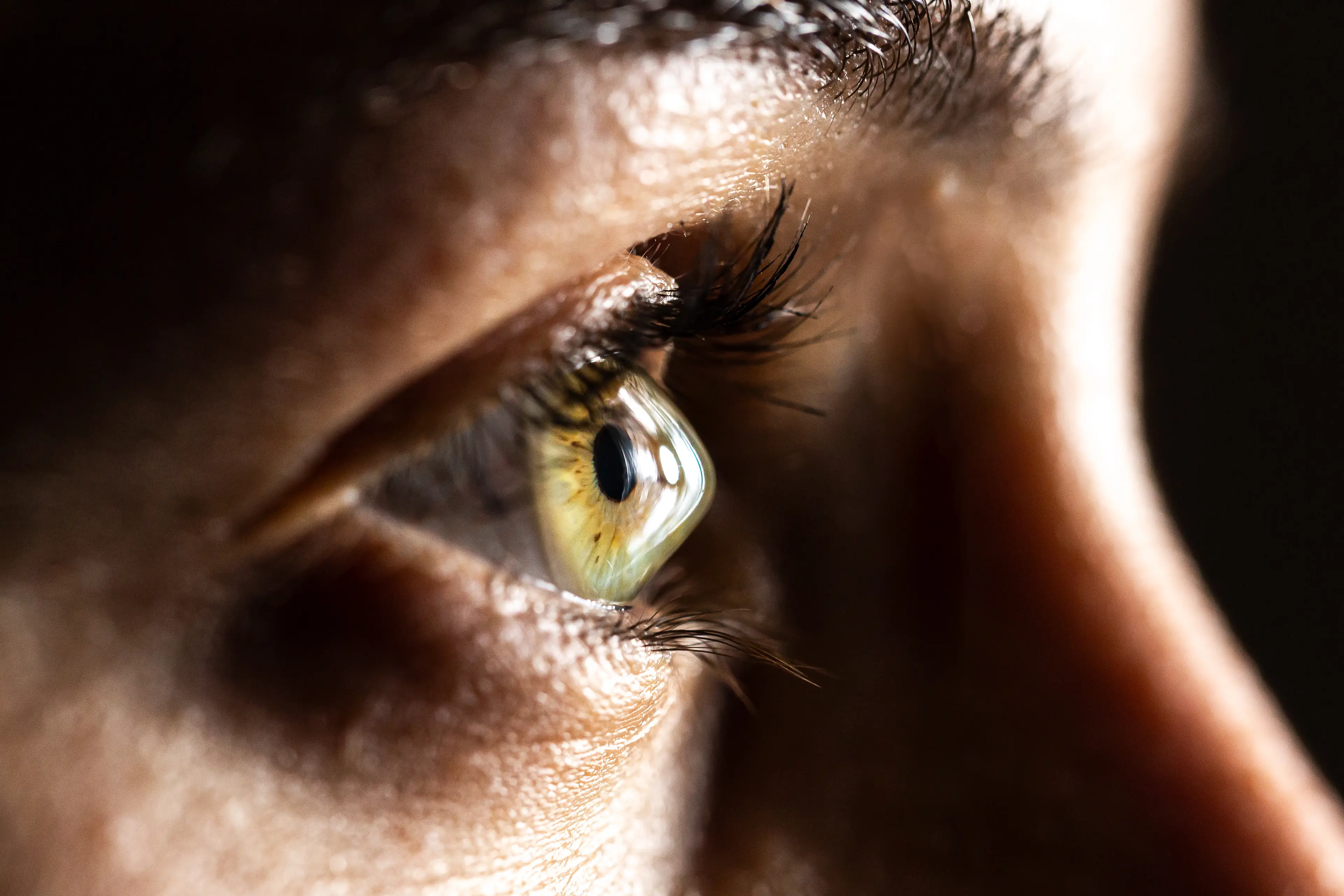 You can develop a ring around your iris if you start to suffer from keratoconus (iStock/Getty Images Plus)