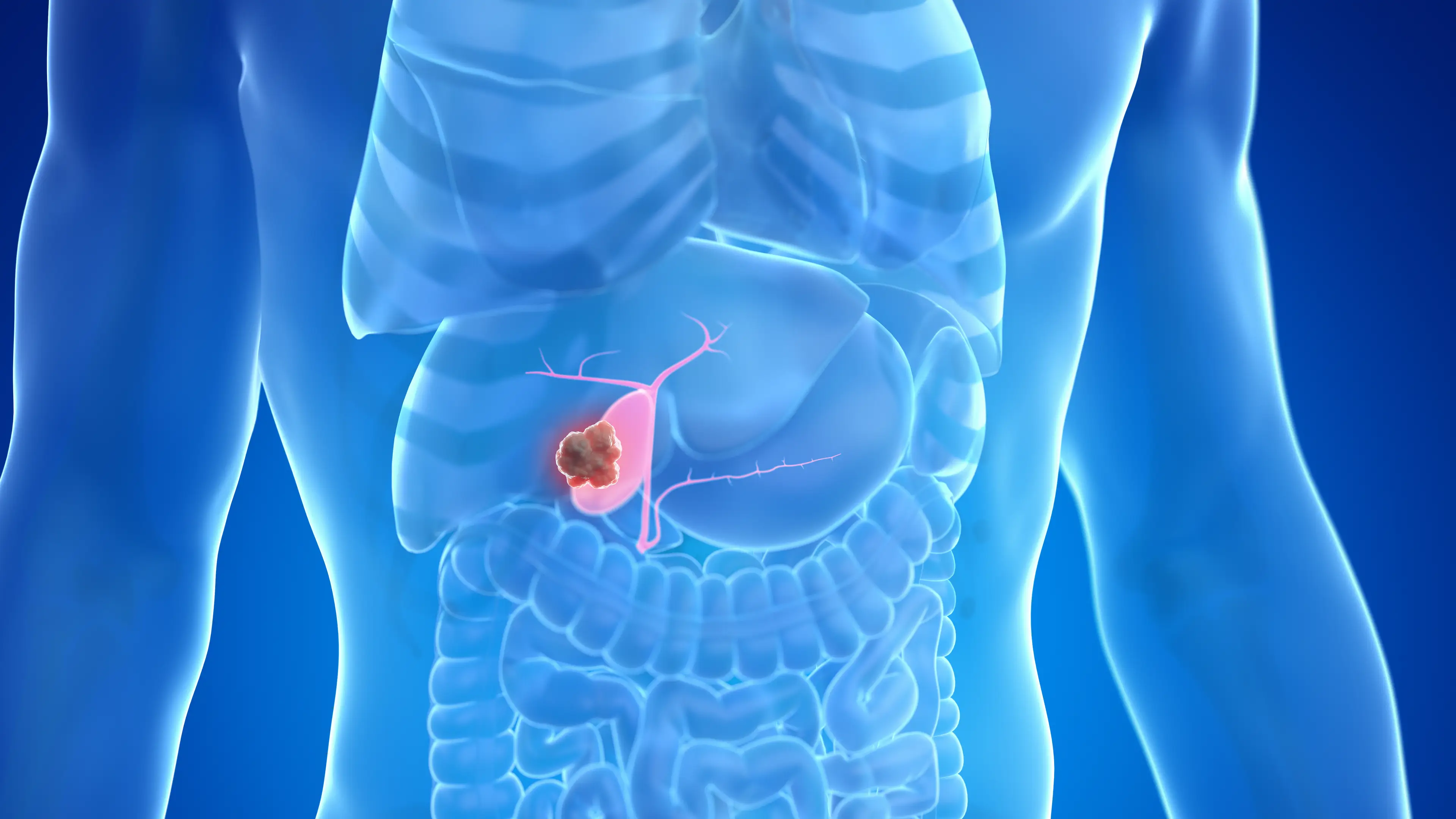 In the UK there has been an increase of young people with gallbladder cancer (Getty Stock Image)