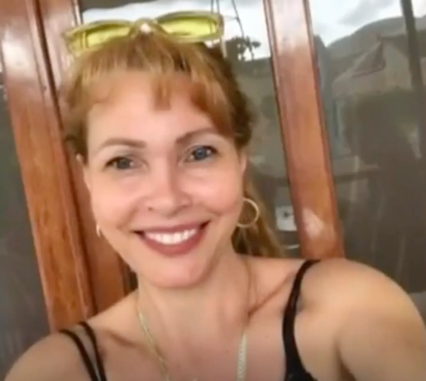 Daidys Pena Garces underwent the procedure in May 2023 (WSVN-TV)