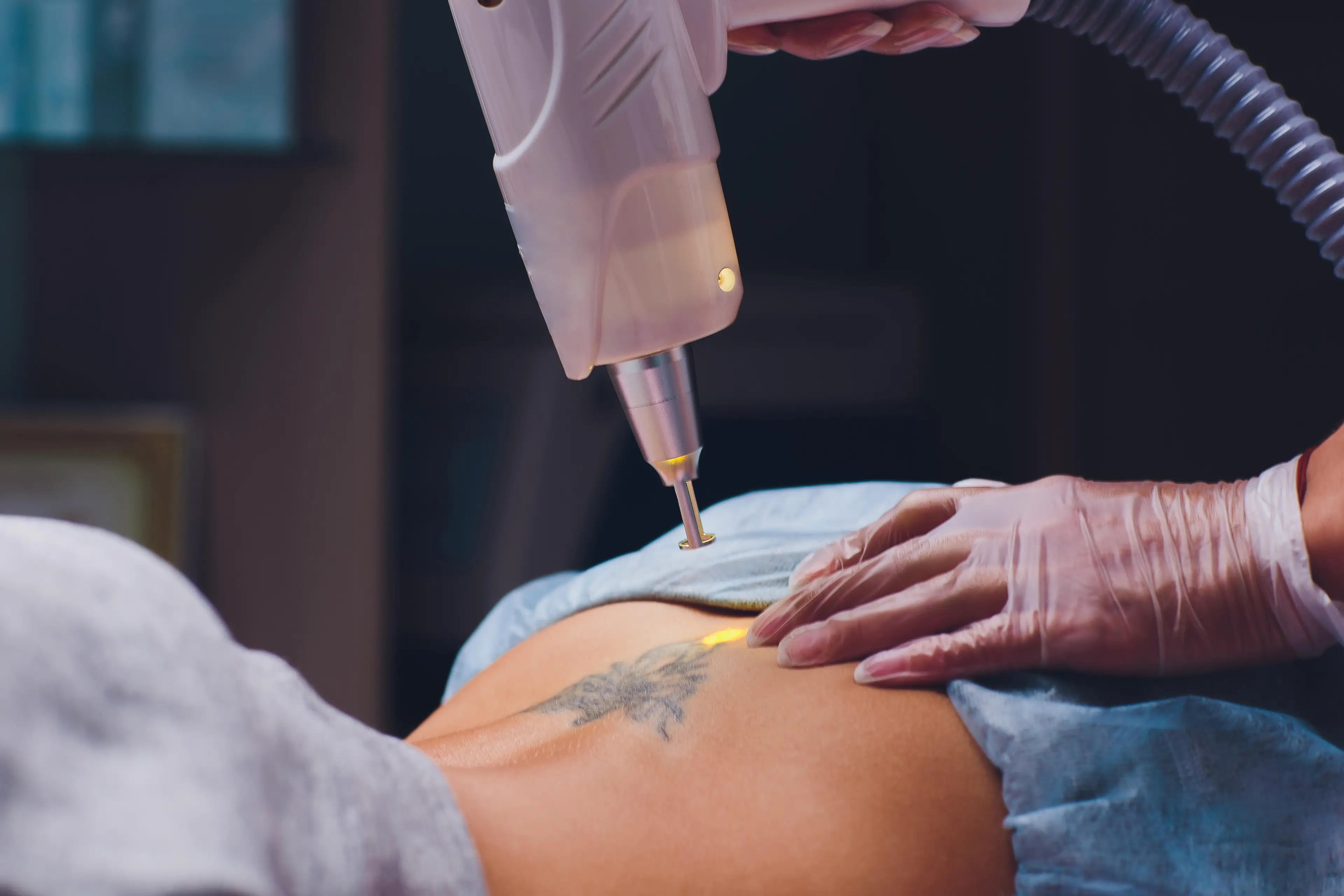 The body's immune system helps to get rid of the ink particles.