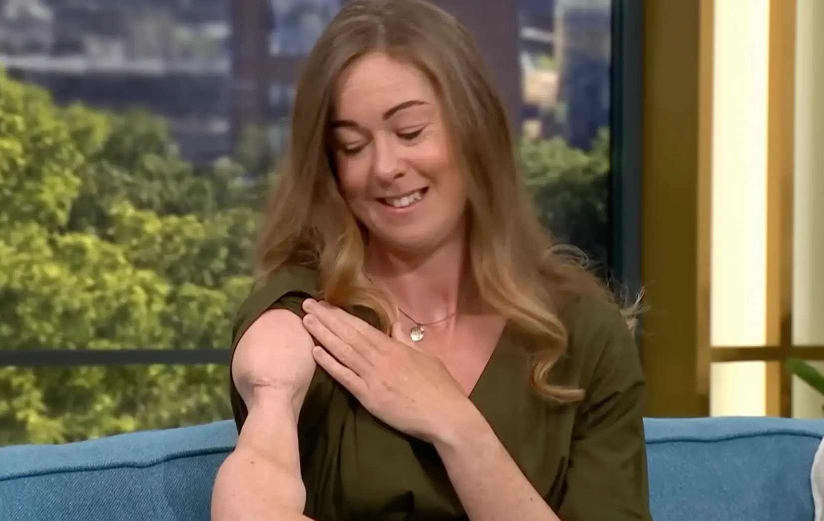 Fairlamb was able to avoid having her arm completely amputated following the attack. (This Morning)