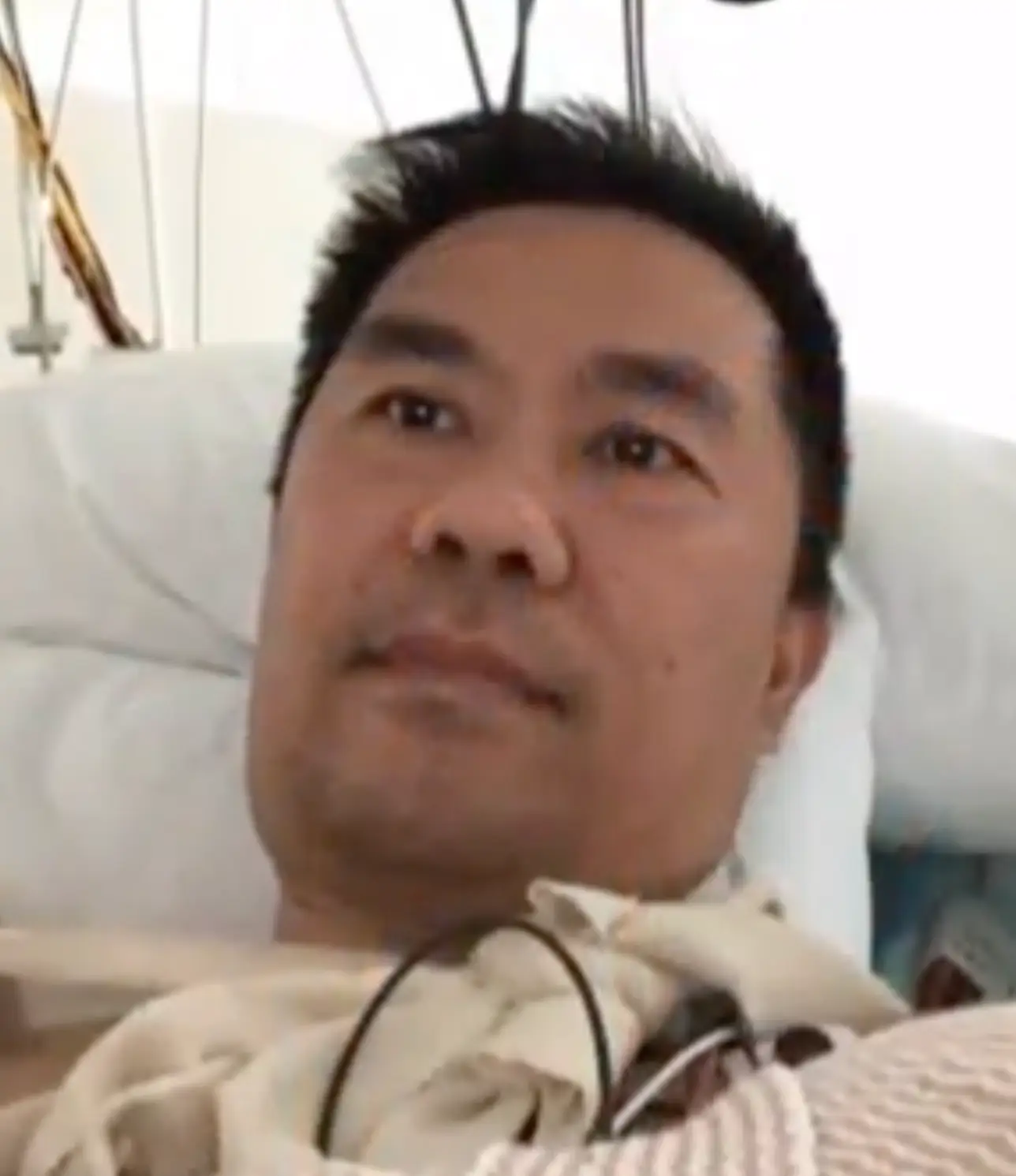 Li had to endure 15 months of therapy after the attack.