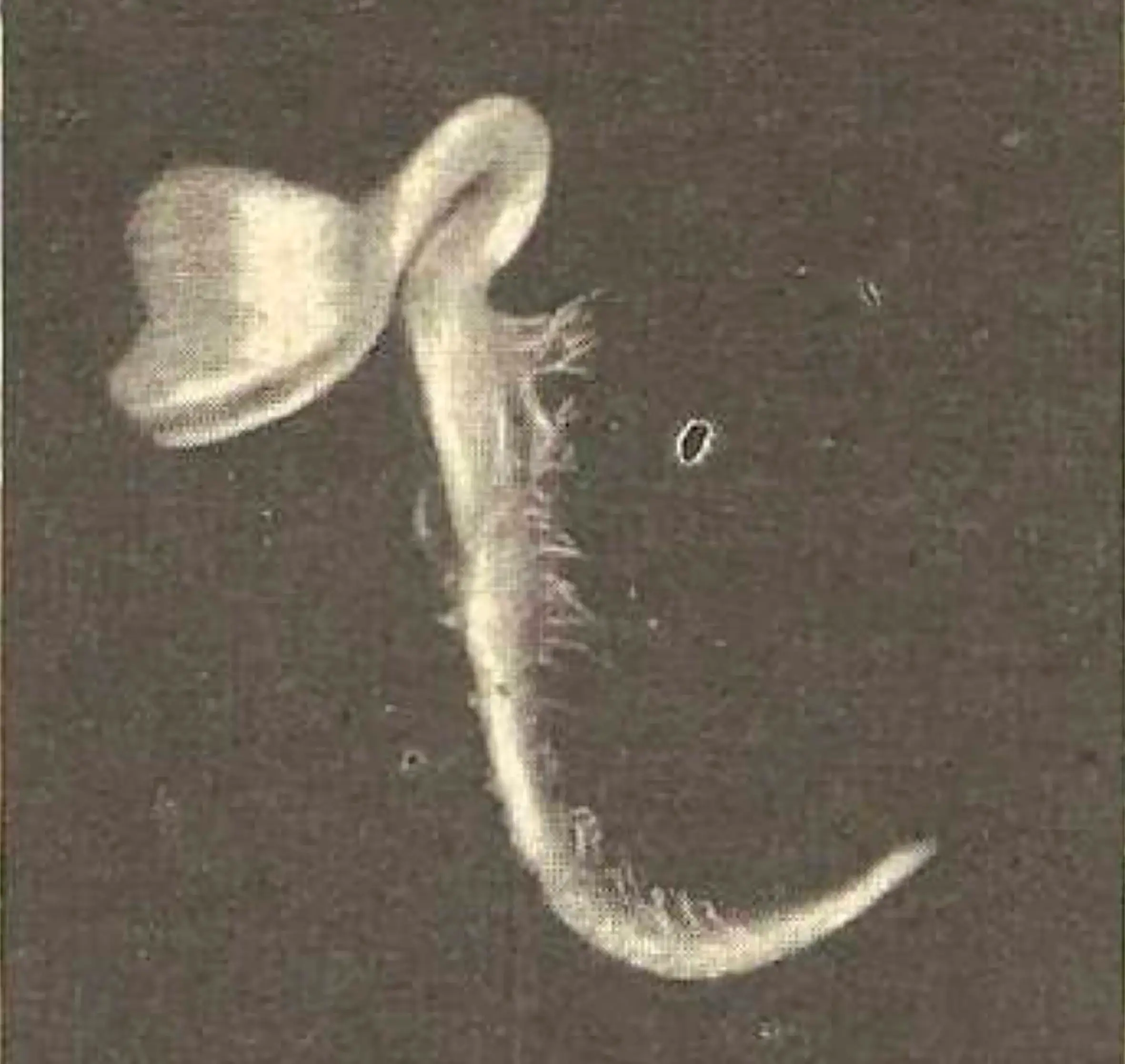 Maxim Sleptsov, 42, had been carrying a seed that had germinated in his eye (East2West)