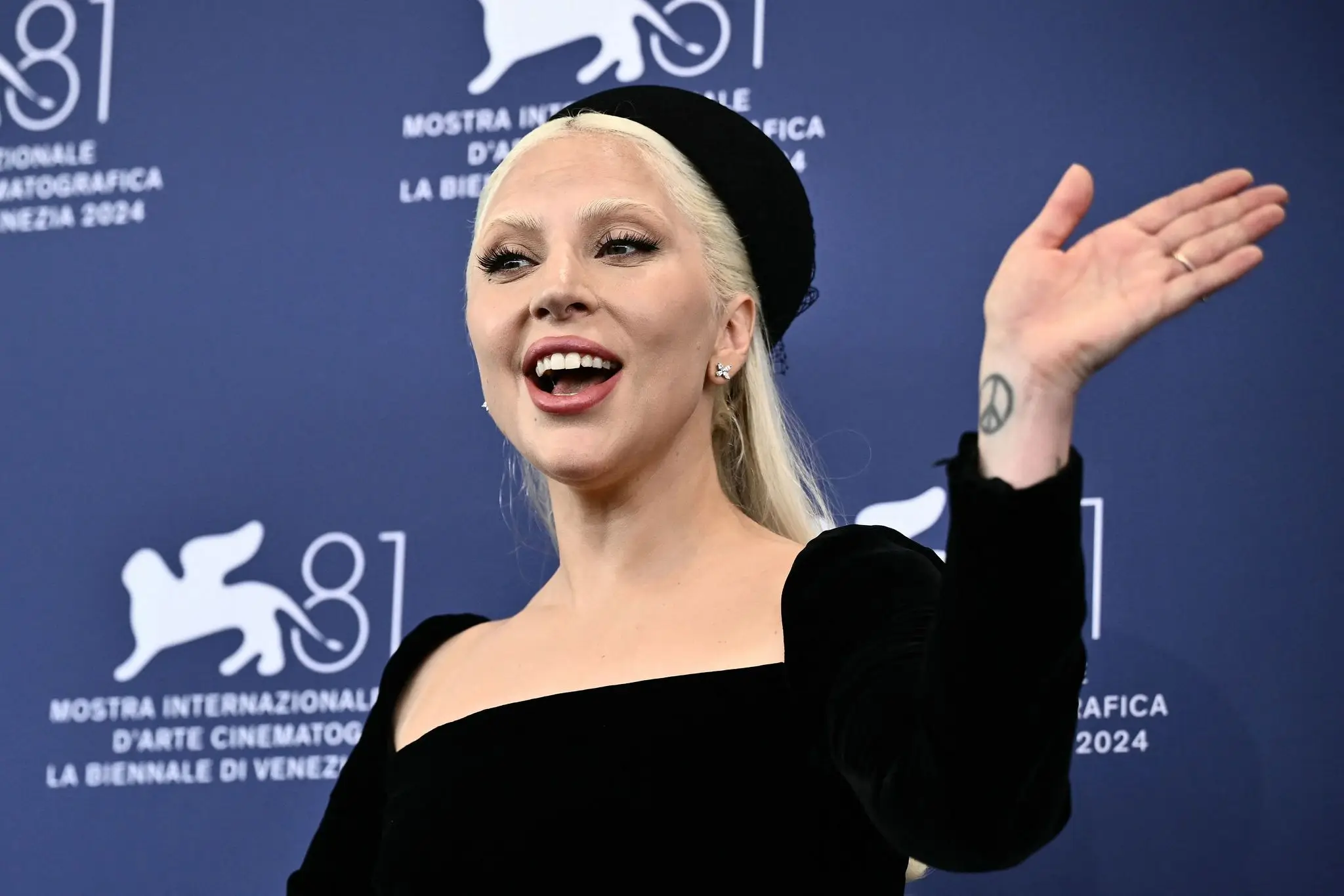 Lady Gaga is one of the most successful musicians of her generation. (MARCO BERTORELLO/AFP via Getty Images)