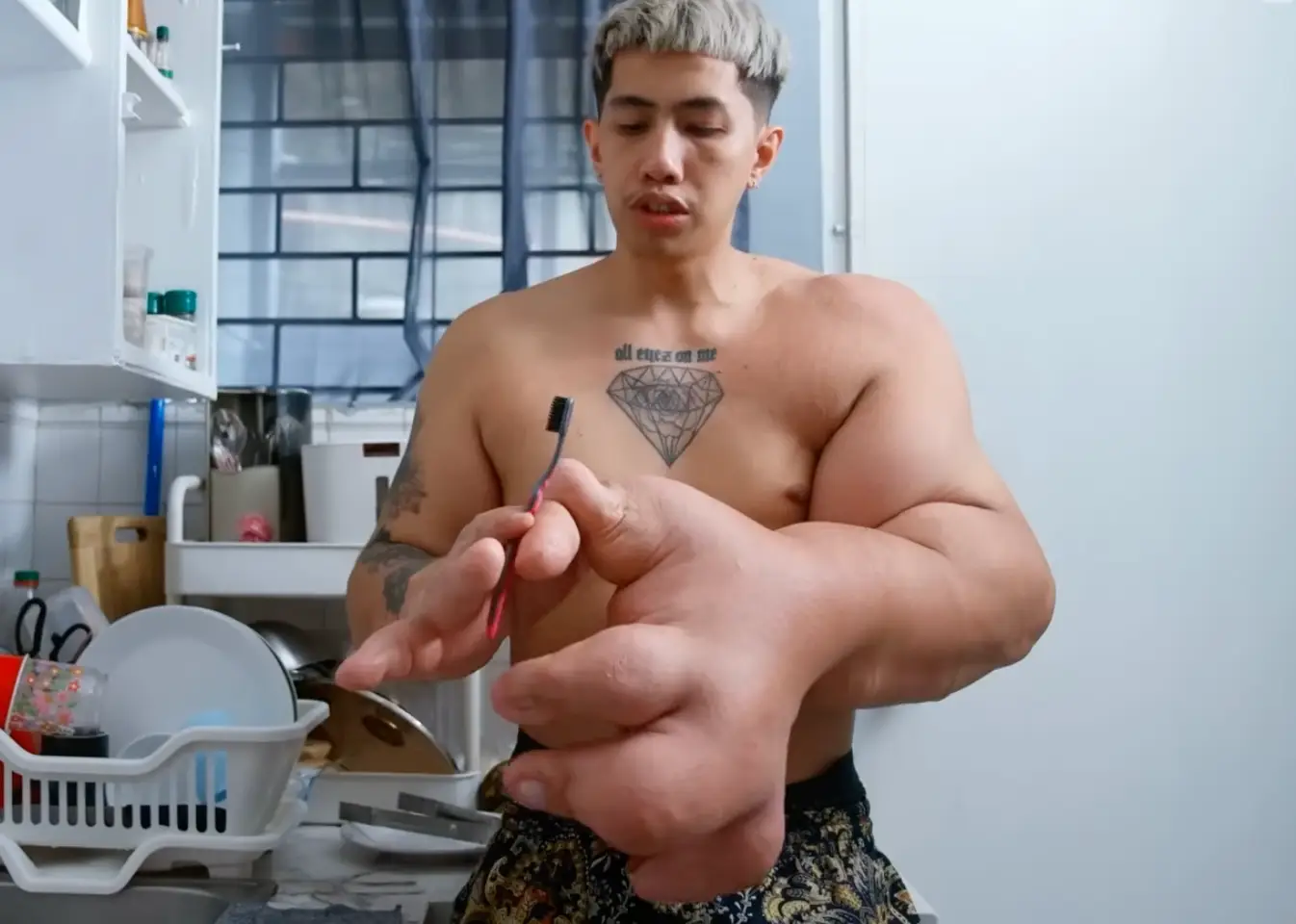 Many people living with rare physical conditions say public perception has shifted in the age of social media, with more curiosity and support replacing stigma. (TLC)