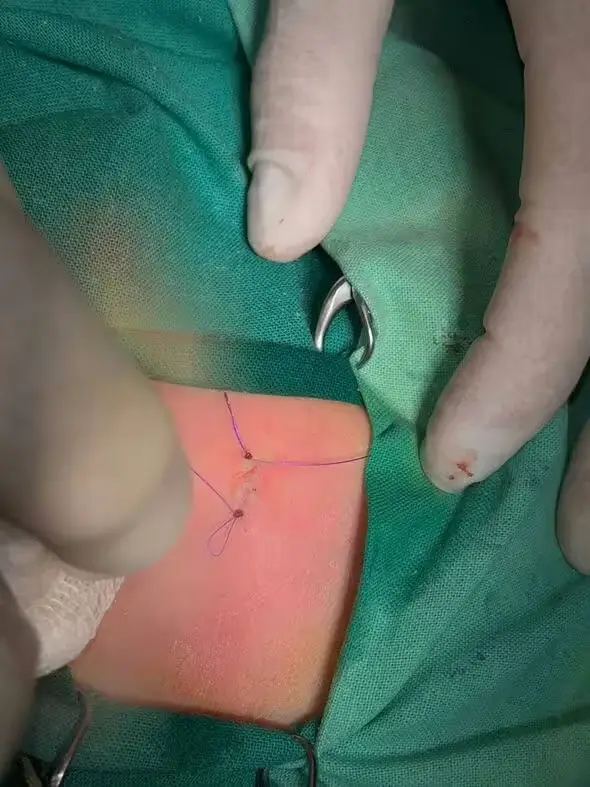 Both mother and child are reportedly doing well. (Newsflash)