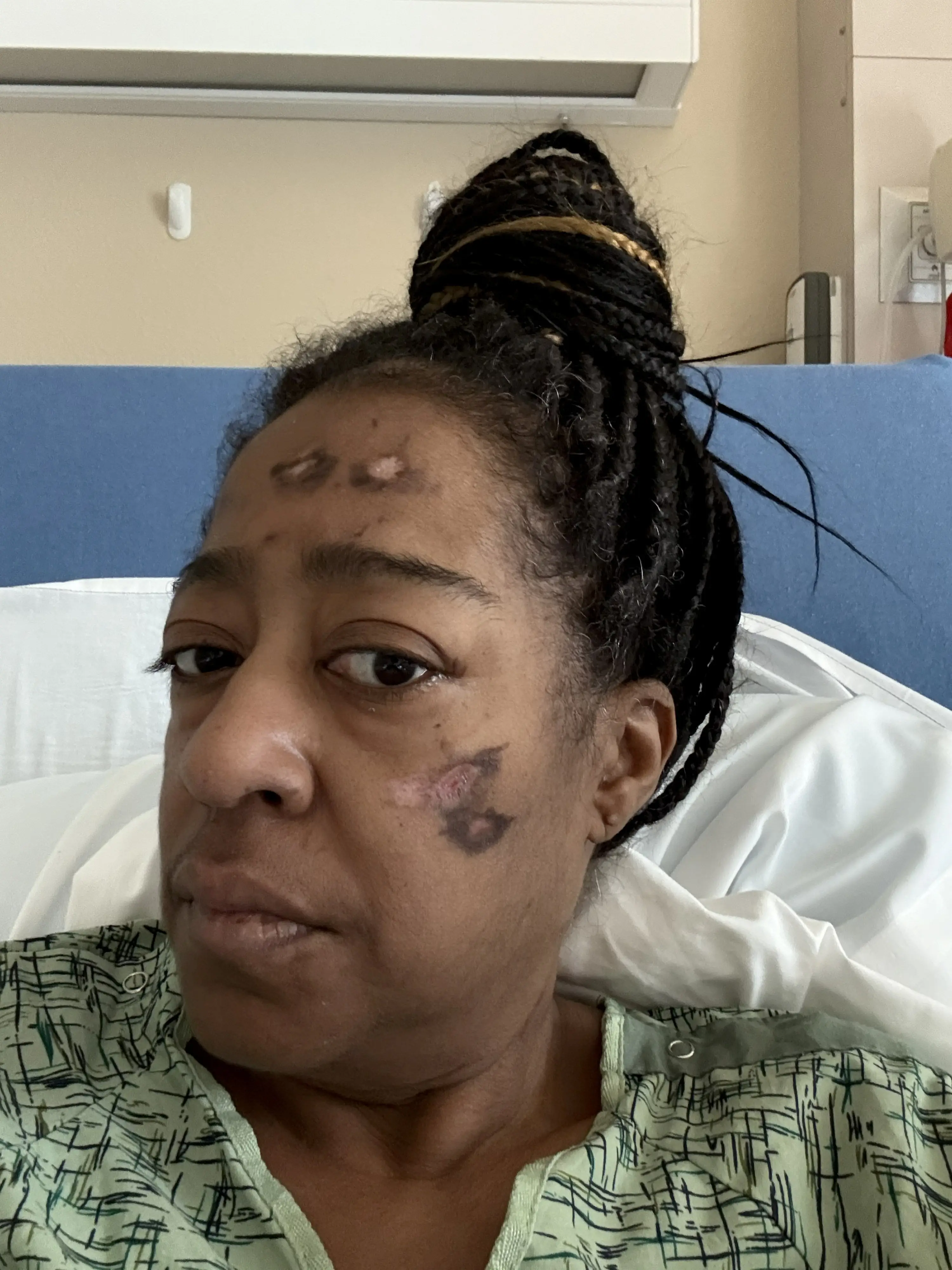 Denise remembers nothing after the ambulance arrived until waking 40 days later (SWNS)