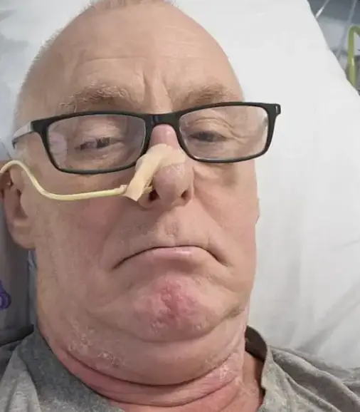 The Brit noticed the lump on the right side of his neck (Kennedy News and Media)