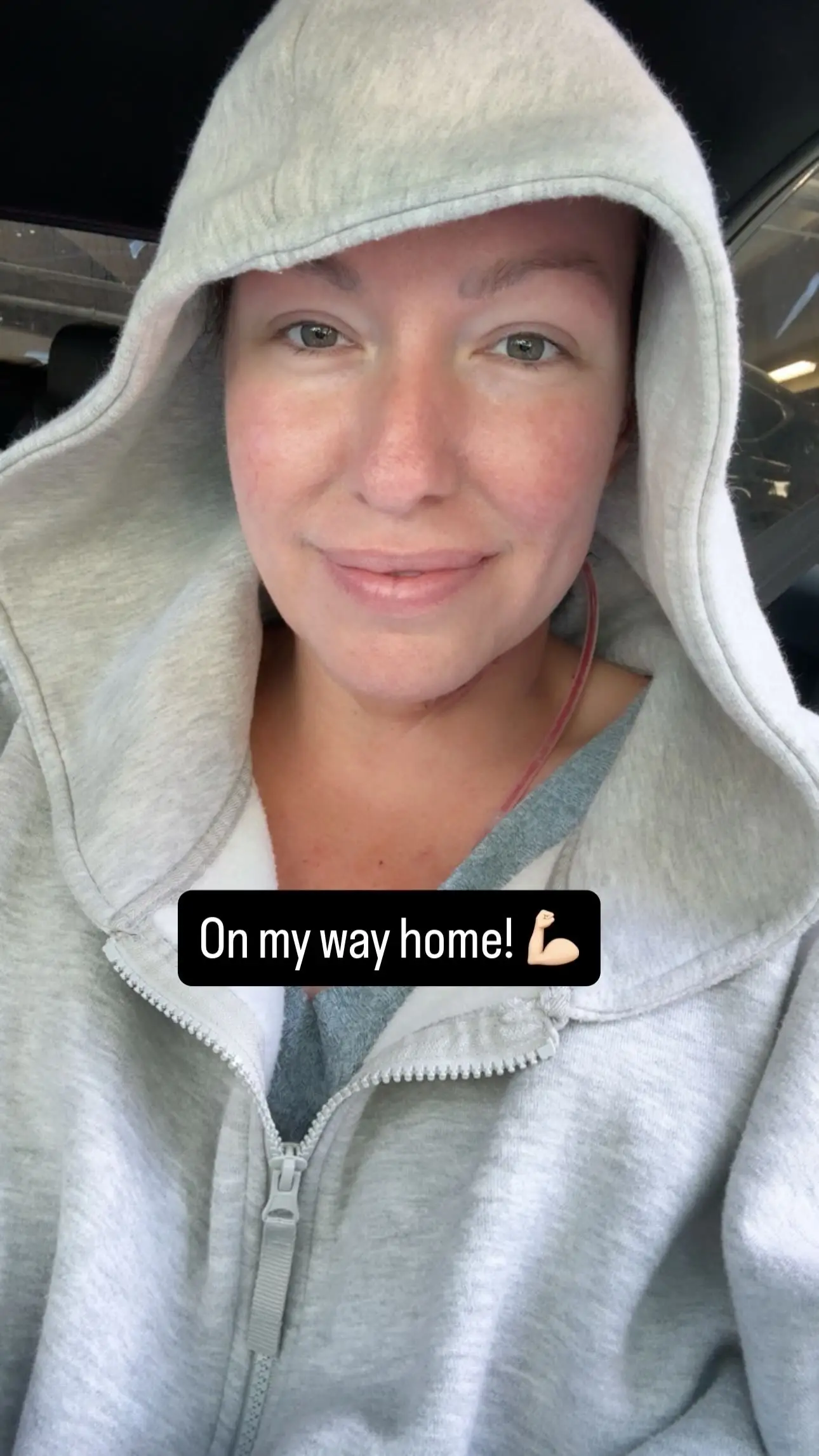 She had tongue cancer (Rachel Passarella)