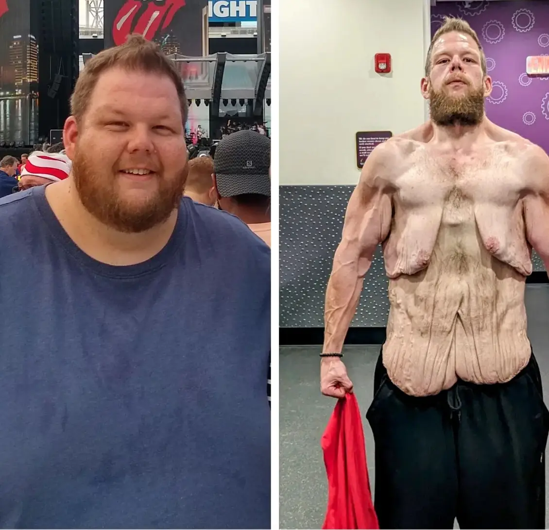 Prochaska has lost over 300 pounds.  (Instagram/ @3to1fitness)