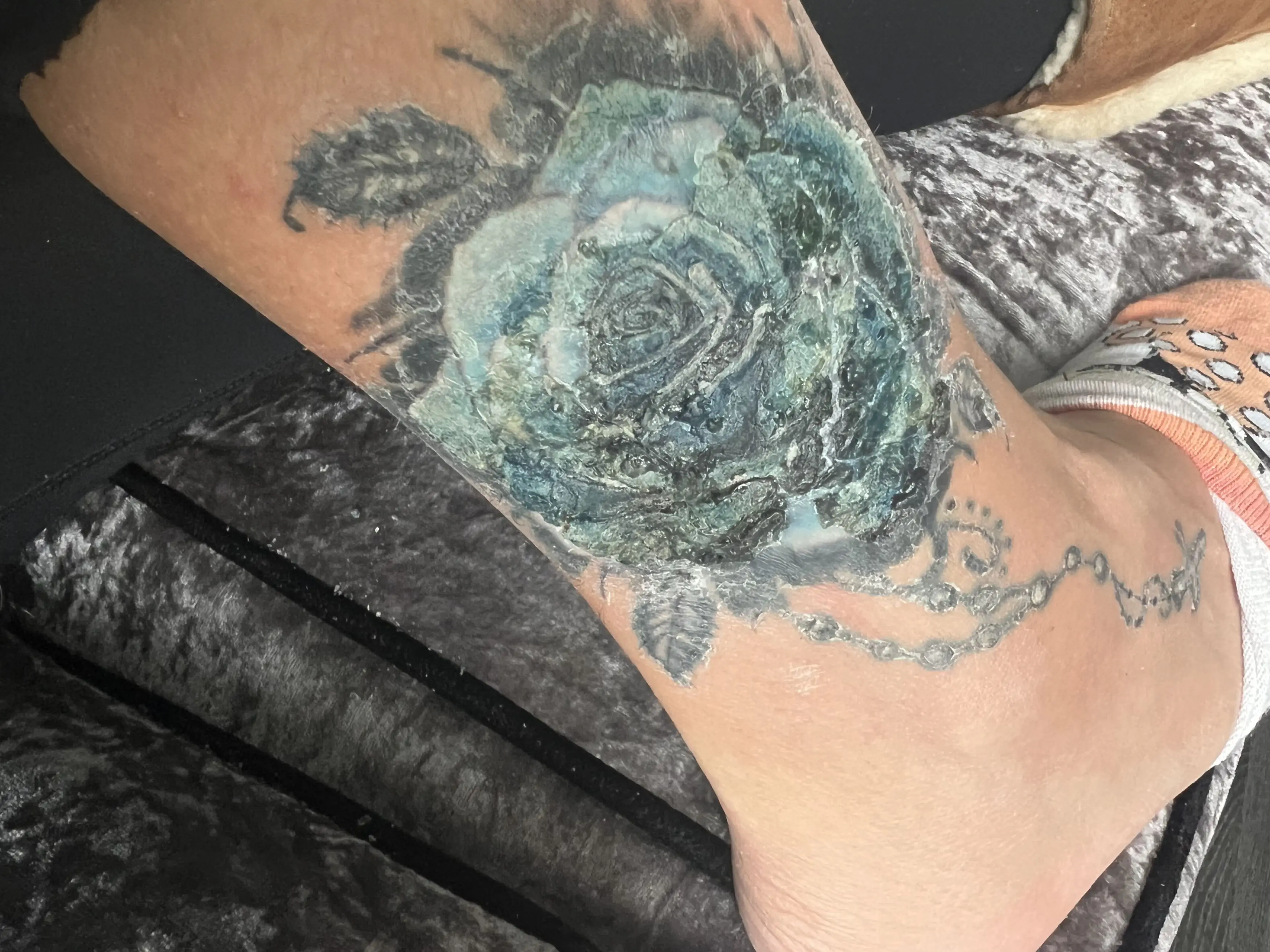 Griffiths' tattoo began to blister and fluid seeped out, the mom explained (Kennedy News and Media)