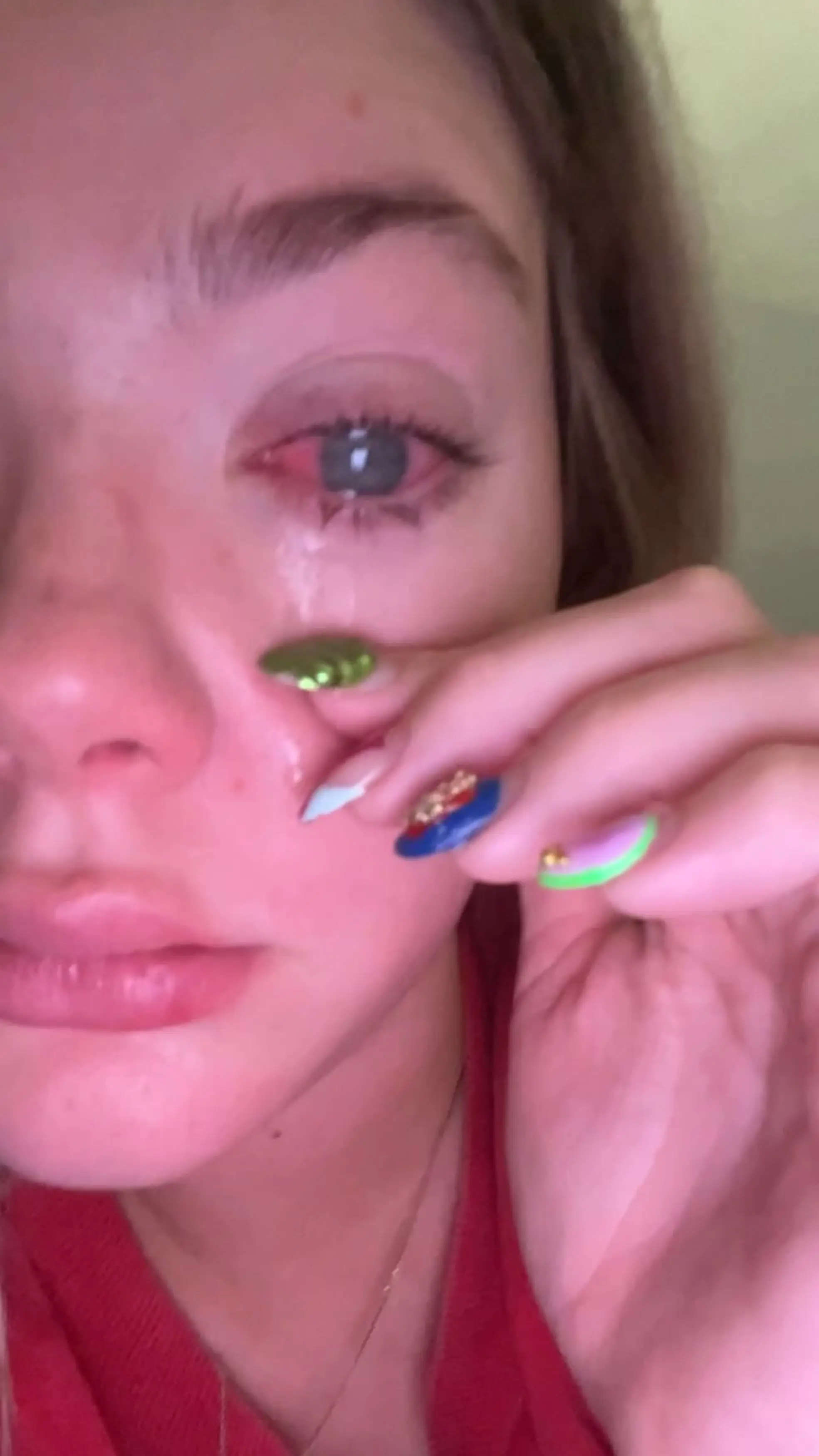 It turns out there was a parasite infection in Brooklyn's eye (Kennedy News and Media) 