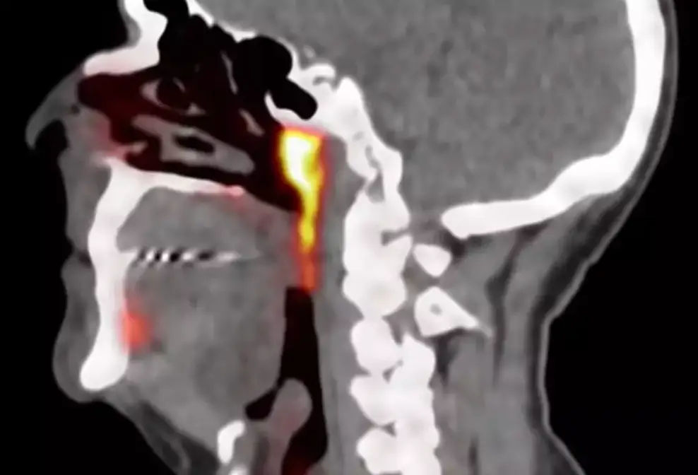 It was discovered through 'sensitive' scans (YouTube/Antoni Van Leeuwenhoek)