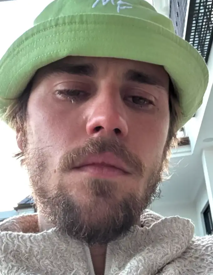 Fans have become concerned for Bieber. (Instagram/ @justinbieber)