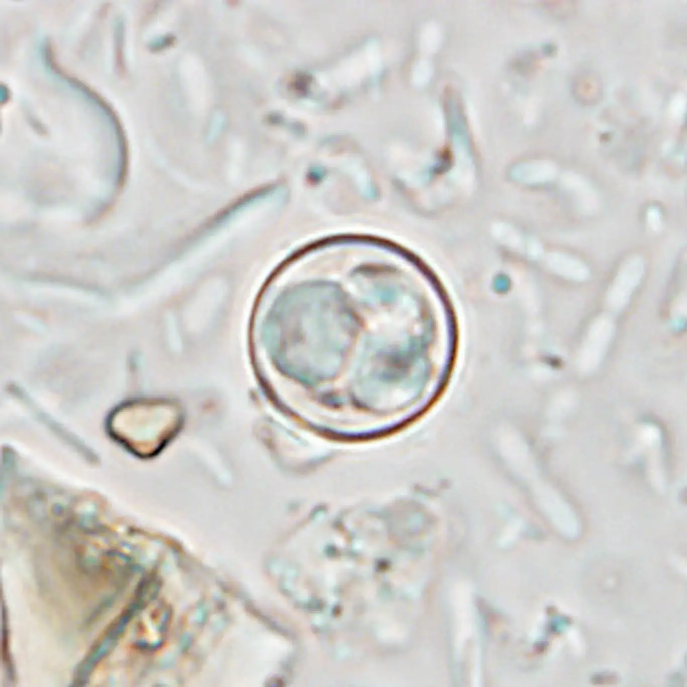 People infected by the parasite can experience some very unpleasant symptoms (Centers for Disease Control and Prevention)