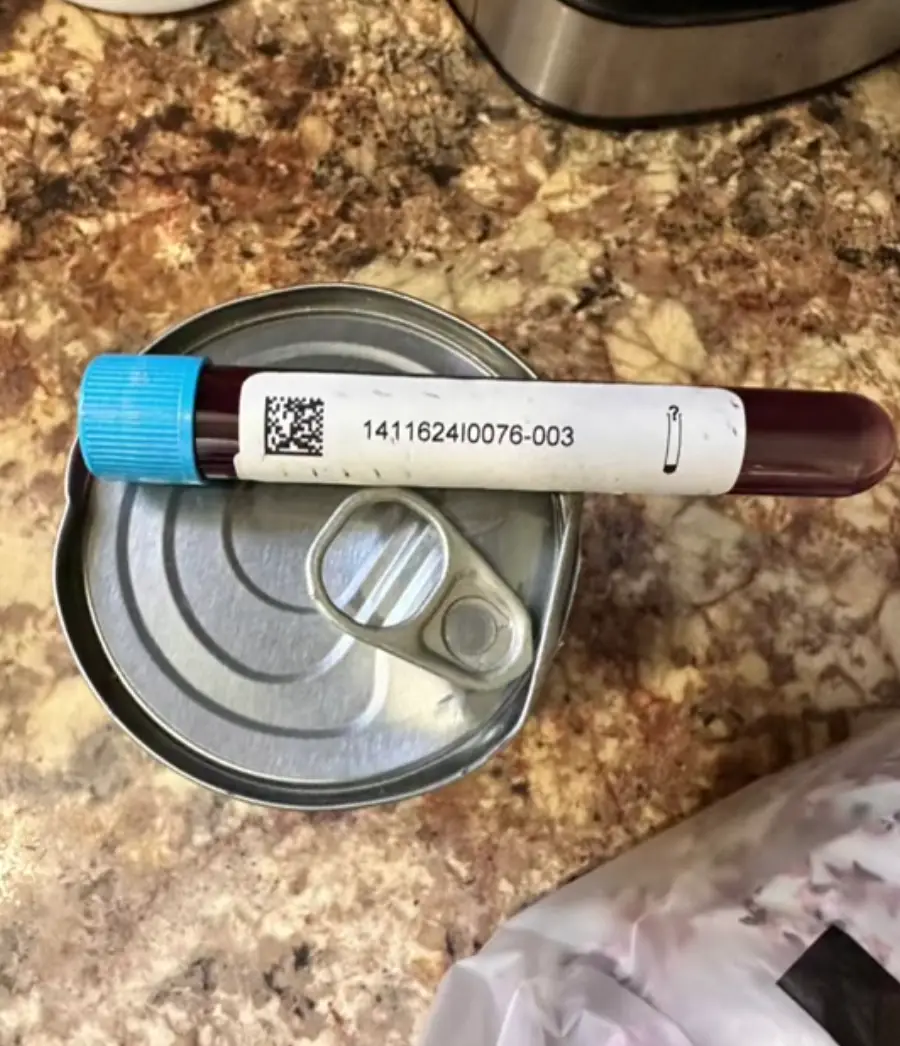 Anna Marie discovered the vile of blood in her package.