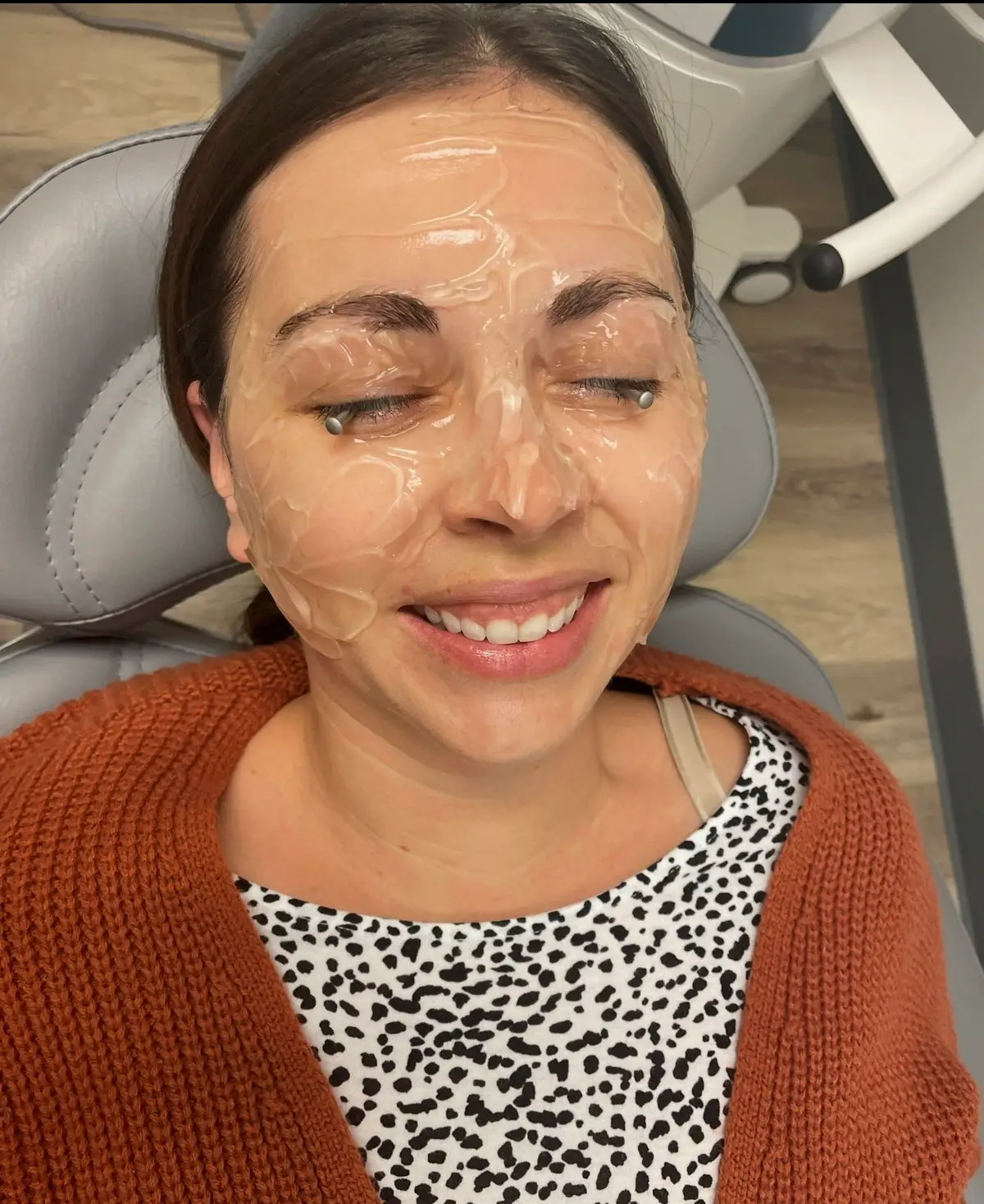 She says she now has a routine to prevent corneal tears (SWNS)