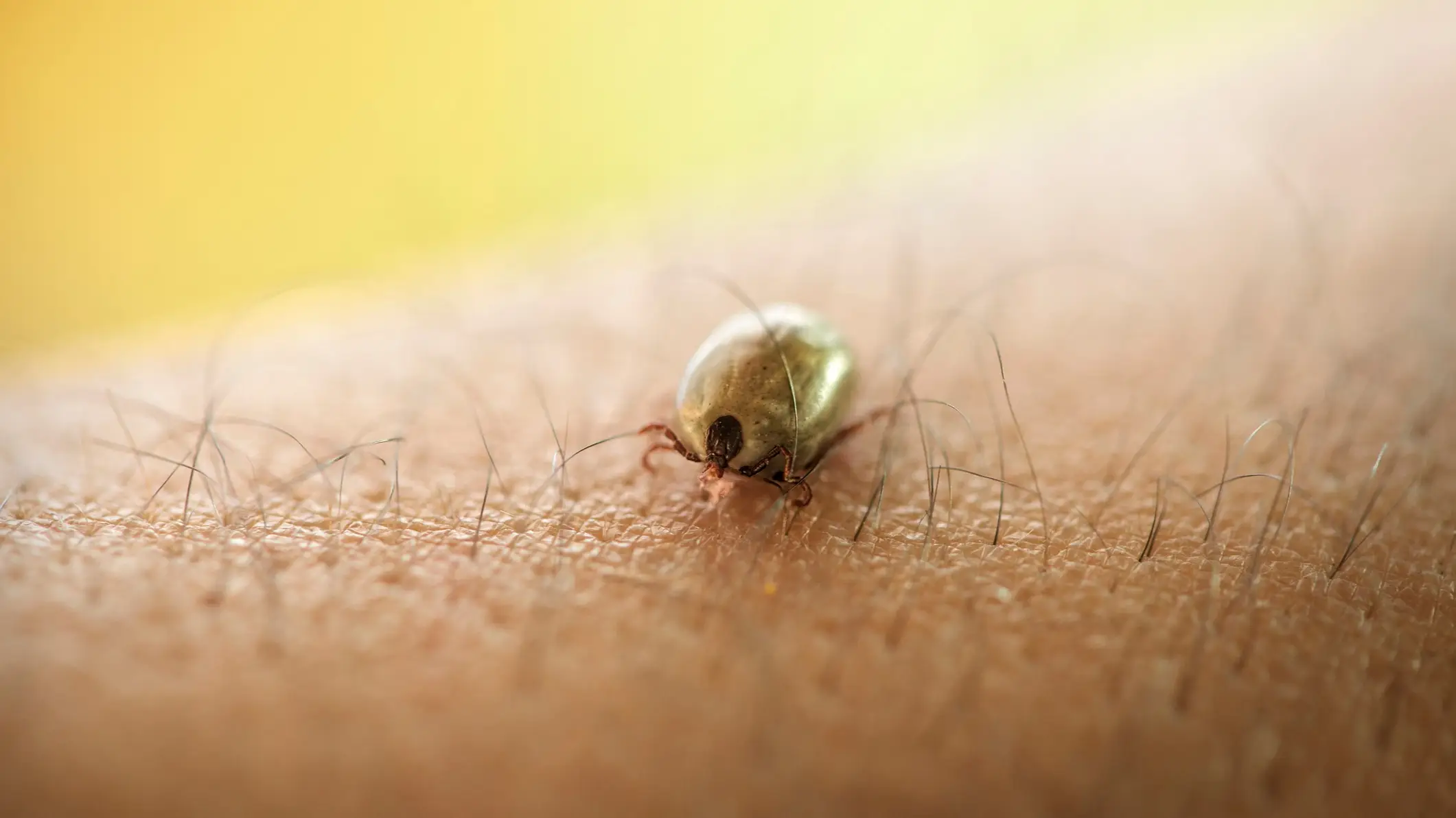 Zeljkosantrac/Getty Images