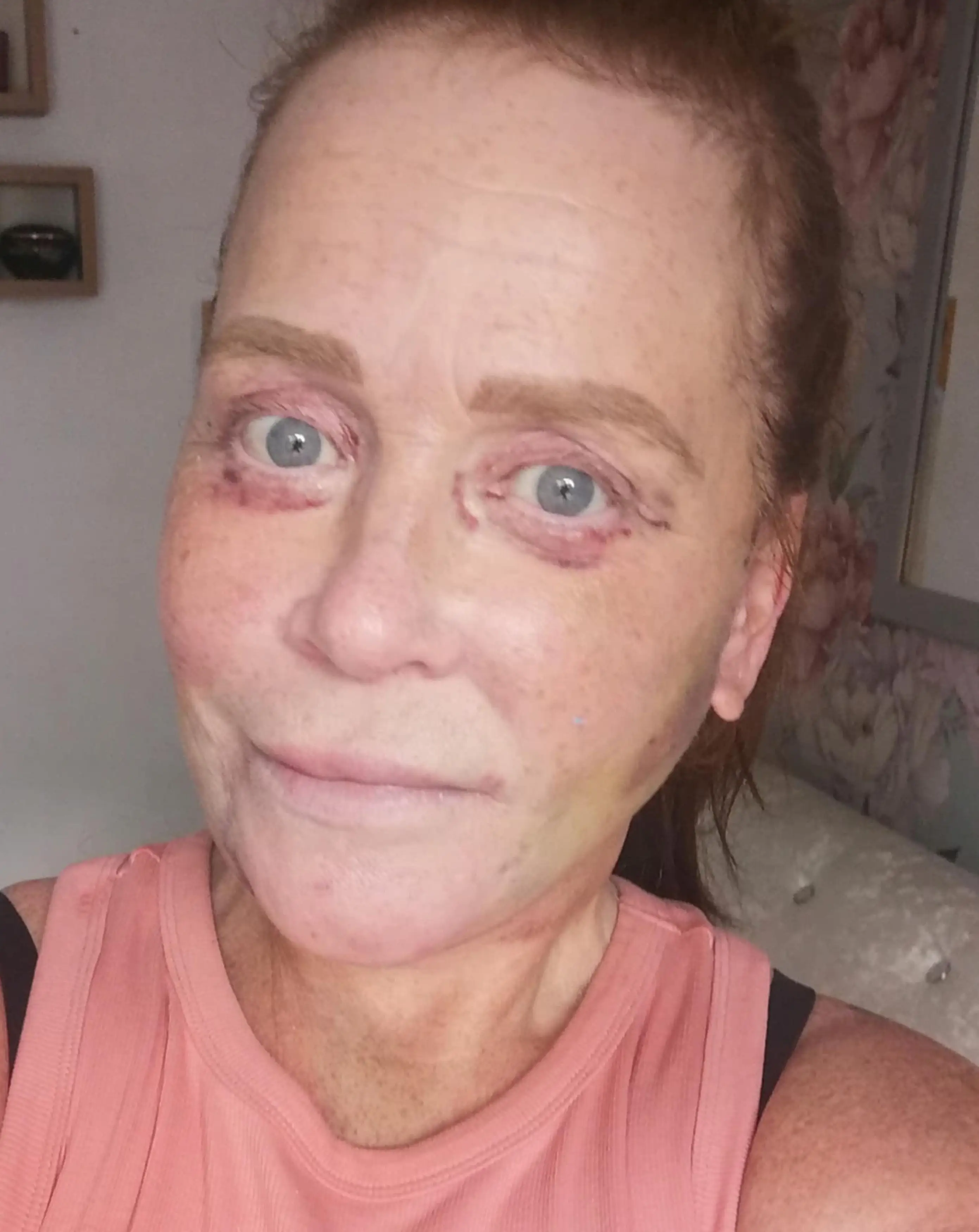 Joanne Law spent thousands on a botched surgery in Turkey (Kennedy)