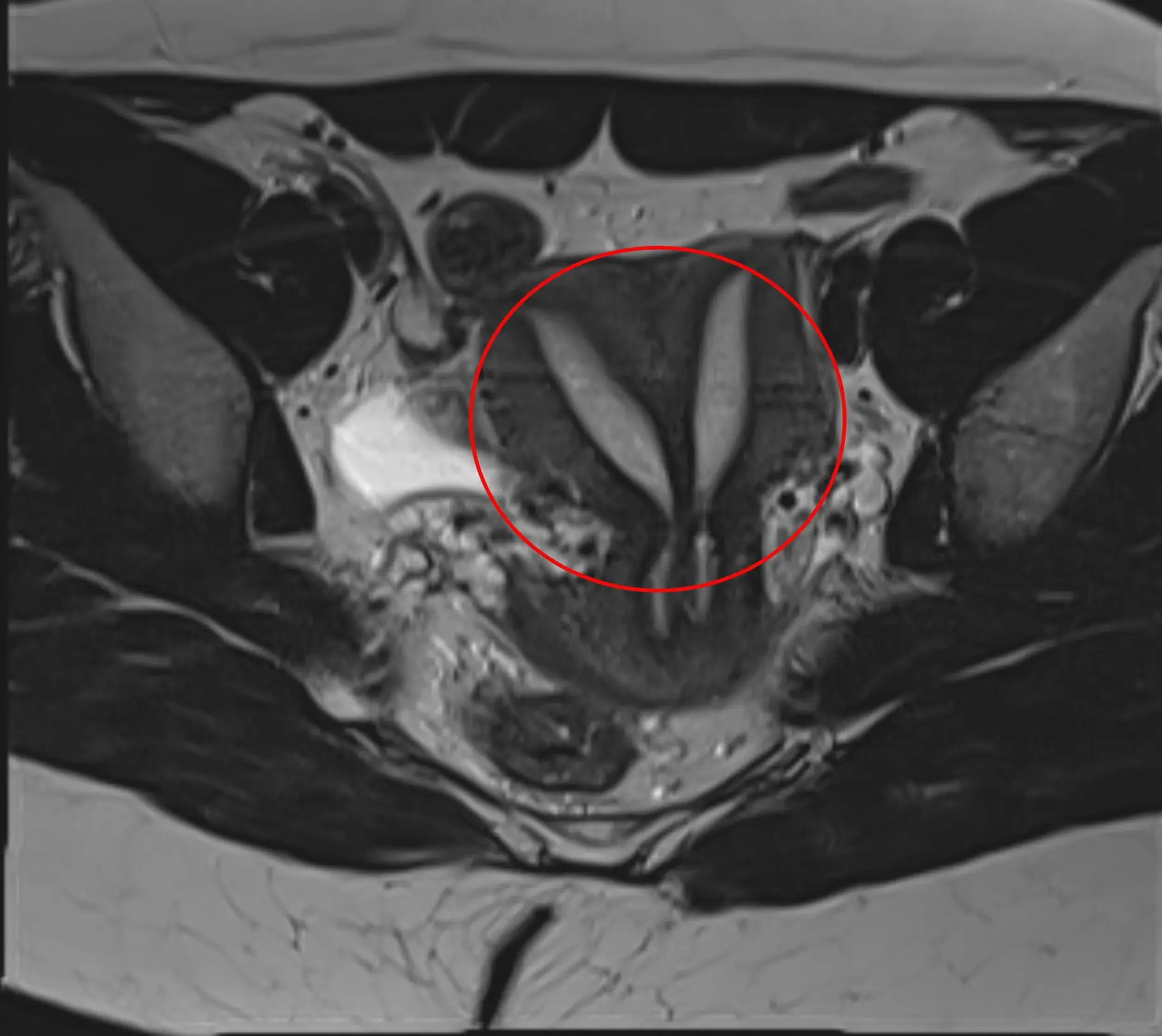 An MRI of a woman with uterus didelphys (Paul Biris/Getty Stock)