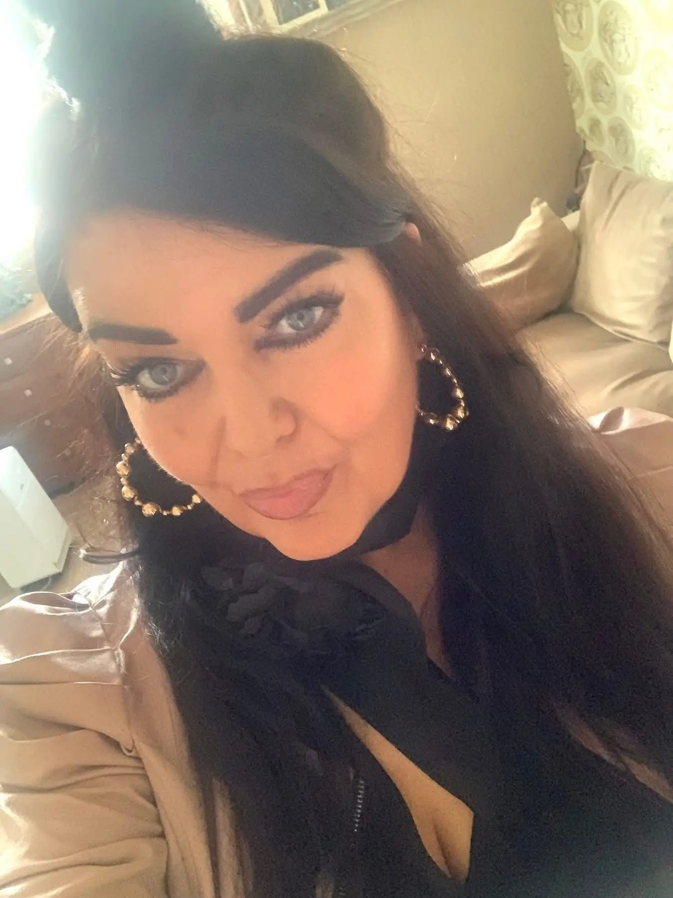 The businesswoman ended up needing an invasive surgery (SWNS)