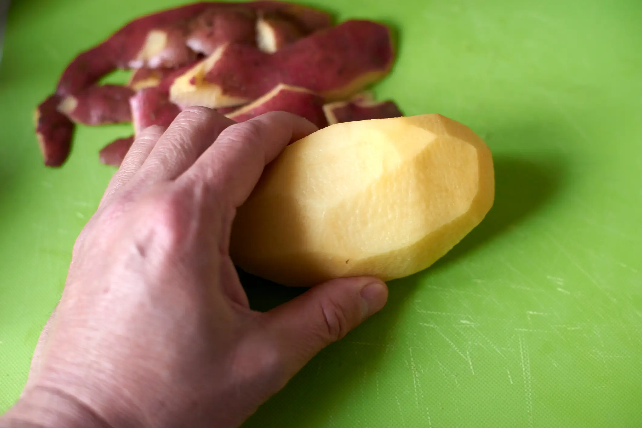 Dr Xand advised viewers against putting peeled potatoes on their heads when suffering migraines (Getty Stock)