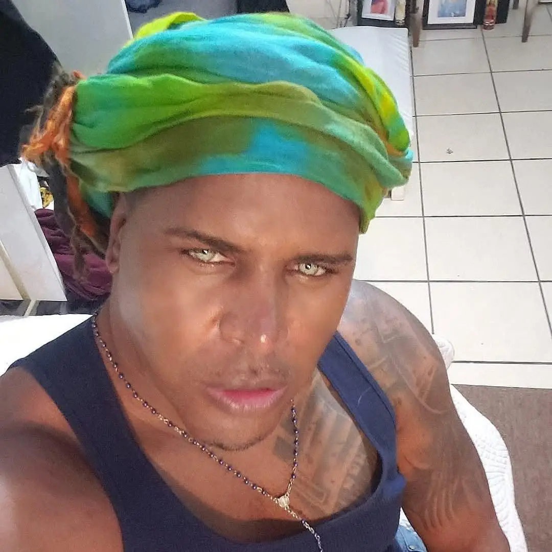 David said he experienced headaches, constant light sensitivity, red eyes, itching, and a gritty feeling like there was sand in his eyes after the implants (Supplied)