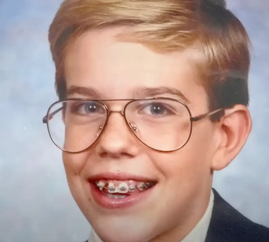 Ed Helms explained he never had a tooth in that spot.