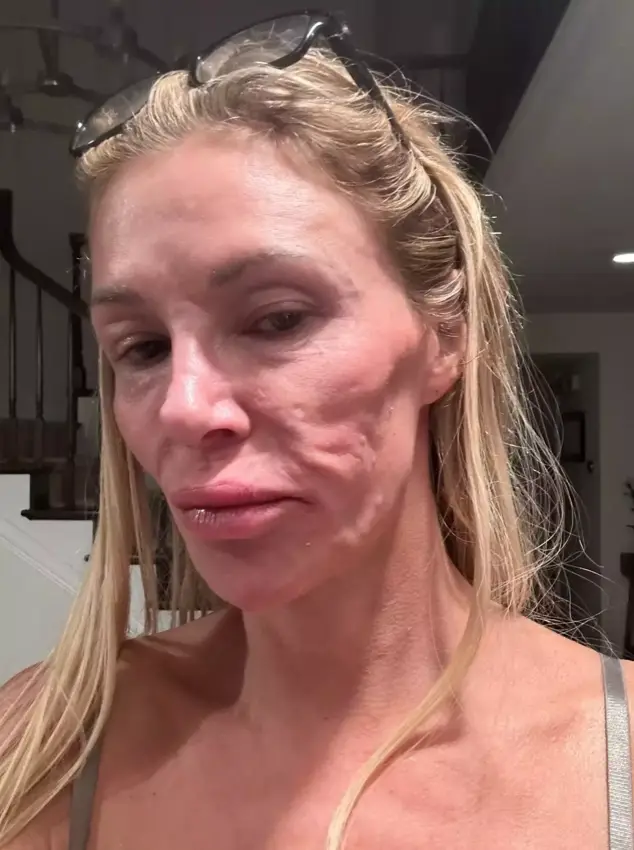 Fans voiced their concerns over the former model (Twitter/@BrandiGlanville)