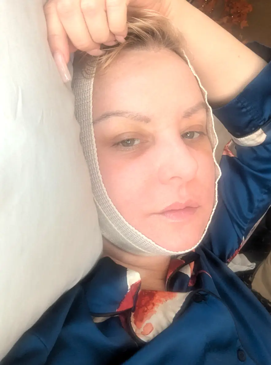 Wendi McLendon-Covey is recovering from a neck lift (wendimclendoncovey/Instagram) 
